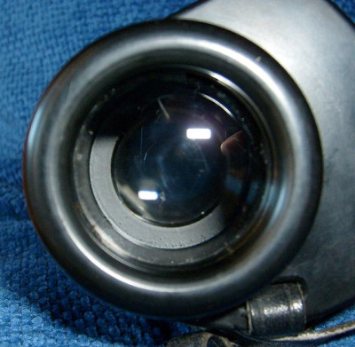B S interno attraverso lenet frontale dx